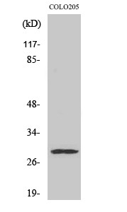Western blot analysis of various cells using Peroxin 11β Polyclonal Antibody diluted at 1:500 STJ95036
