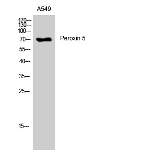 Western blot analysis of A549 cells using Peroxin 5 Polyclonal Antibody STJ95042