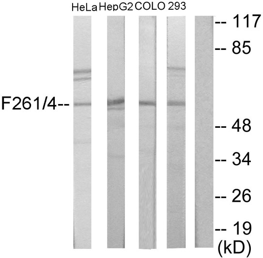 Western blot analysis of lysates from HeLa, HepG2, COLO205, and 293 cells, using PFKFB1/4 Antibody. The lane on the right is blocked with the synthesized peptide.