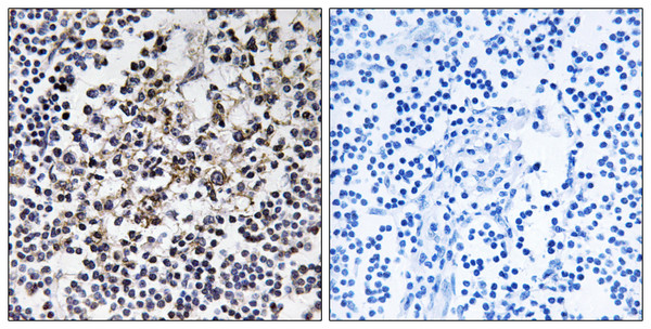 Immunohistochemistry analysis of paraffin-embedded human lymph node tissue, using PGLS Antibody. The picture on the right is blocked with the synthesized peptide.