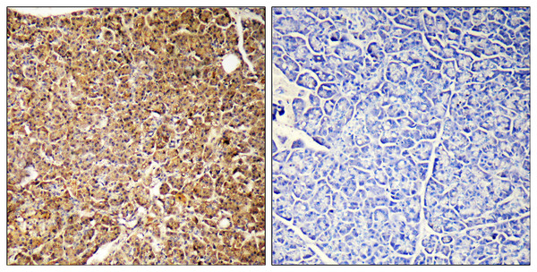 Immunohistochemistryt analysis of paraffin-embedded human pancreas, using PIK3CG Antibody. The lane on the right is blocked with the PIK3CG peptide.