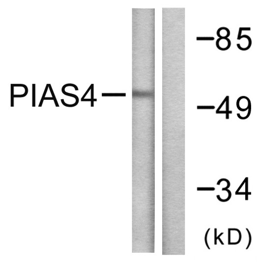 Western blot analysis of lysates from Jurkat cells, using PIAS4 Antibody. The lane on the right is blocked with the synthesized peptide. Western blot analysis of lysates from Jurkat cells, using PIAS4 Antibody. The lane on the right is blocked with the synthesized peptide.