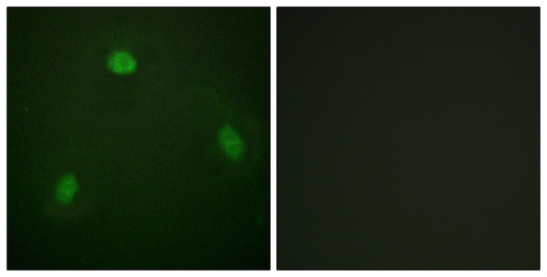 Immunofluorescence analysis of NIH/3T3 cells, using Pin1 Antibody. The picture on the right is blocked with the synthesized peptide.