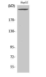 Western Blot analysis of various cells using PIP5KIII Polyclonal Antibody STJ95099