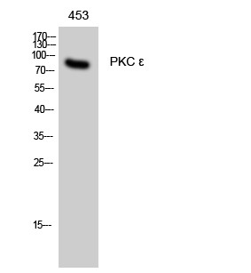 Western Blot analysis of 453 cells using PKC ε Polyclonal Antibody diluted at 1:500 STJ95128