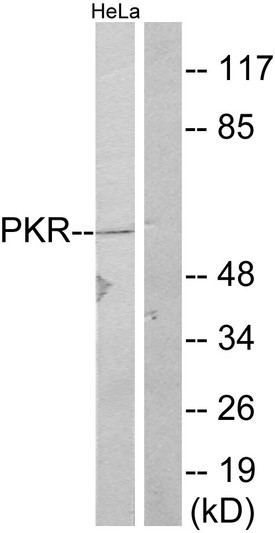 Western blot analysis of lysates from HeLa, using PKR Antibody. The lane on the right is blocked with the synthesized peptide.