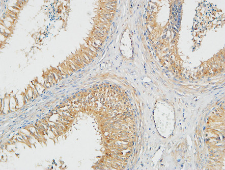 Immunohistochemical analysis of paraffin-embedded Human testis. 1, Antibody was diluted at 1:200 (4°C overnight). 2, High-pressure and temperature EDTA, pH8.0 was used for antigen retrieval. 3, Secondary antibody was diluted at 1:200 (room temperature, 30min).