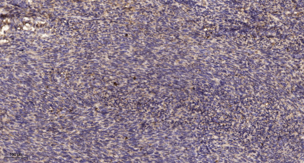 Immunohistochemical analysis of paraffin-embedded human uterus. 1, Antibody was diluted at 1:200 (4° overnight). 2, STJ95152