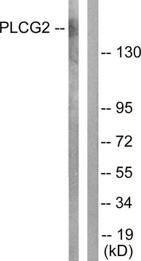 Western blot analysis of lysates from Raw264.7 cells, treated with PMA 125ng/ml 30', using PLCG2 Antibody. The lane on the right is blocked with the synthesized peptide.