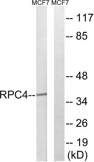 Western blot analysis of lysates from MCF-7 cells, using RPC4 Antibody. The lane on the right was blocked with the STJ95181