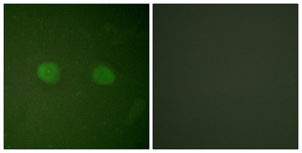 Immunofluorescence analysis of HeLa cells, using PPAR-alpha Antibody. The picture on the right is blocked with the synthesized peptide.