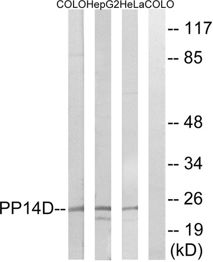 Western blot analysis of lysates from HeLa, HepG2, and COLO cells, using PPP1R14D Antibody. The lane on the right is blocked with the synthesized peptide.
