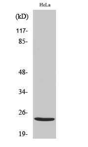 Western blot analysis of various cells using PPP1R14D polyclonal antibody STJ95202