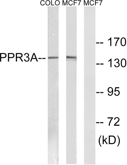 Western blot analysis of lysates from MCF-7 and COLO cells, using PPP1R3A Antibody. The lane on the right was blocked STJ95205