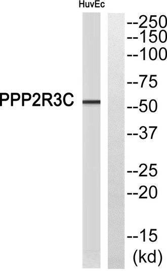Western blot analysis of PPP2R3C Antibody. The lane on the right is blocked with the PPP2R3C peptide. Western blot analysis of PPP2R3C Antibody. The lane on the right is blocked with the PPP2R3C peptide.