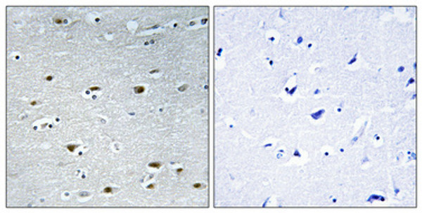 Immunohistochemical analysis of paraffin-embedded Human brain. Antibody was diluted at 1:100 (4°C overnight). High-pressure and temperature Tris-EDTA, pH8.0 was used for antigen retrieval. Negetive contrl (right) obtaned from antibody was pre-absorbed by immunogen peptide.