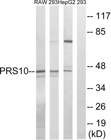 Western blot analysis of lysates from HepG2, 293, and RAW264.7 cells, using PSMC6 Antibody. The lane on the right is blocked with the synthesized peptide.