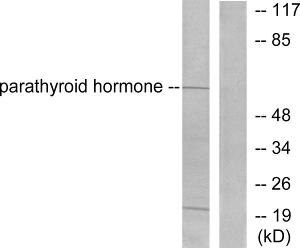 Western blot analysis of lysates from A549 cells, using Parathyroid Hormone Antibody. The lane on the right is blocked with the synthesized peptide.