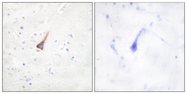 Immunohistochemistry analysis of paraffin-embedded human brain tissue, using PTP1B Antibody. The picture on the right is blocked with the synthesized peptide.