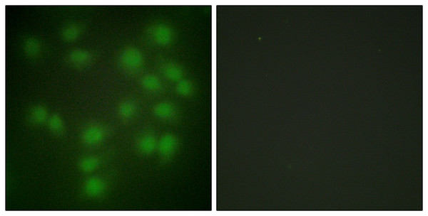 Immunofluorescence analysis of HUVEC cells, using PTTG1 Antibody. The picture on the right is blocked with the synthesized peptide.
