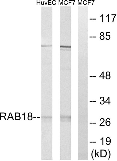 Western blot analysis of lysates from MCF-7 and HUVEC cells, using RAB18 Antibody. The lane on the right is blocked with the synthesized peptide.