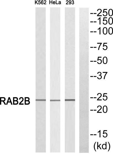 Western blot analysis of RAB2B Antibody. The lane on the right is blocked with the RAB2B peptide.