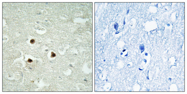 Immunohistochemistry analysis of paraffin-embedded human brain tissue, using RAB3IP Antibody. The picture on the right is blocked with the synthesized peptide.