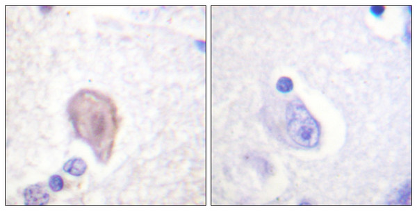 Immunohistochemistry analysis of paraffin-embedded human brain tissue, using C-RAF Antibody. The picture on the right is blocked with the synthesized peptide.