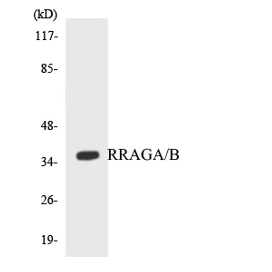 Western blot analysis of the lysates from HepG2 cells using RRAGA/B antibody.