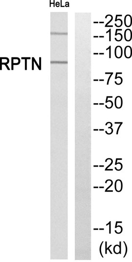 Western blot analysis of RPTN Antibody. The lane on the right is blocked with the RPTN peptide.