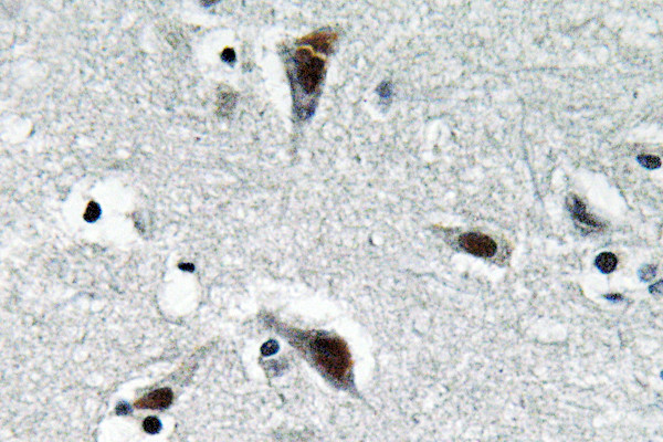 Immunohistochemistry analysis of RFC3 antibody in paraffin-embedded human brain tissue.