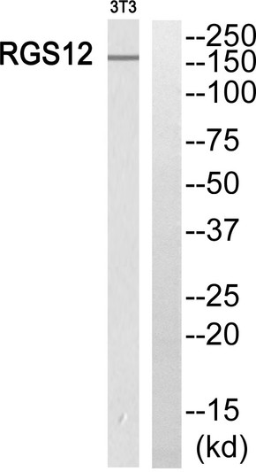 Western blot analysis of RGS12 Antibody. The lane on the right is blocked with the RGS12 peptide.