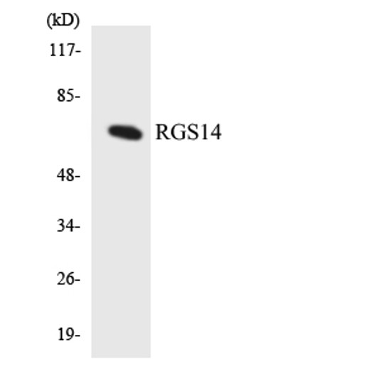 Western blot analysis of the lysates from HUVECcells using RGS14 antibody.