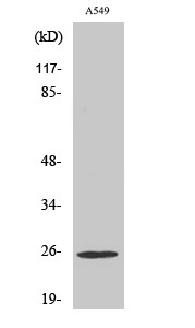 Western blot analysis of various cells using Rho GDIγ Polyclonal Antibody STJ95447