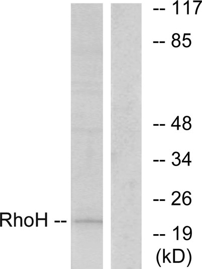 Western blot analysis of lysates from HT-29 cells, using RhoH Antibody. The lane on the right is blocked with the synthesized peptide.