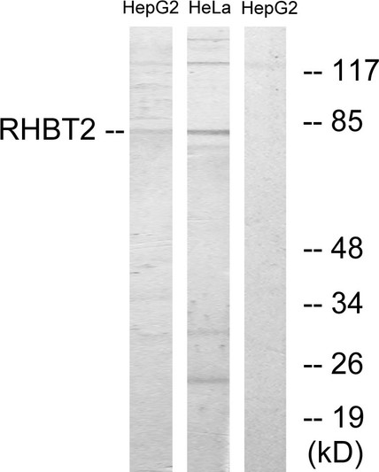 Western blot analysis of lysates from HepG2 and HeLa cells, using RHBT2 Antibody. The lane on the right is blocked with the synthesized peptide.