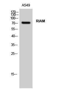 Western blot analysis of A549 cells using RIAM polyclonal antibody STJ95456