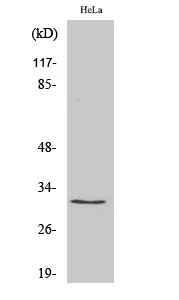 Western blot analysis of various cells using Ribosomal Protein S2 Polyclonal Antibody diluted at 1:2000 STJ95493