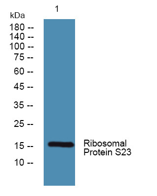 Western blot analysis of lysates from HCT116 cells, primary antibody was diluted at 1:1000, 4°C overnight STJ95496