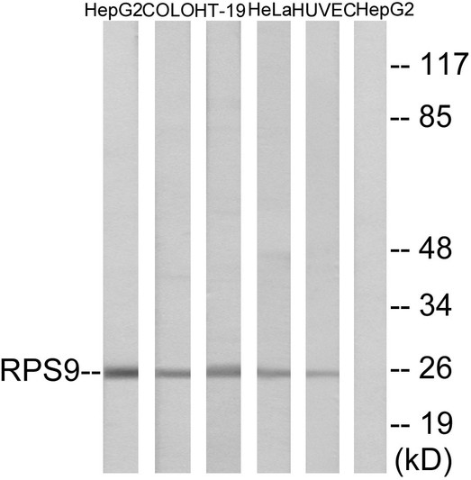 Western blot analysis of lysates from HepG2, COLO, HT-29, HeLa, and HUVEC cells, using RPS9 Antibody. The lane on the right is blocked with the synthesized peptide.