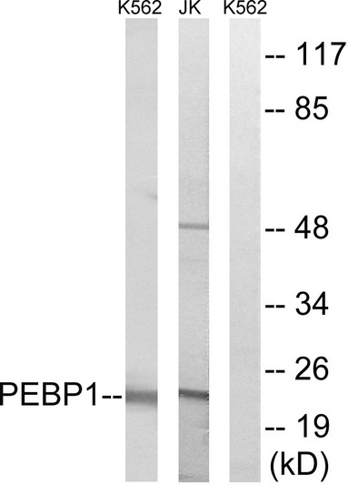 Western blot analysis of lysates from Jurkat and K562 cells, using PEBP1 Antibody. The lane on the right is blocked with the synthesized peptide.