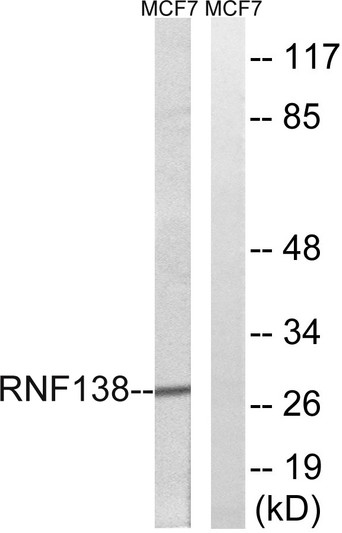 Western blot analysis of lysates from MCF-7 cells, using RNF138 Antibody. The lane on the right was blocked with the STJ95520