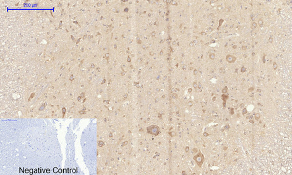 Immunohistochemical analysis of paraffin-embedded Rat-spinal-cord tissue. 1, Rock-1 Polyclonal Antibody was diluted at 1:200 (4°C, overnight). 2, Sodium citrate pH 6.0 was used for antibody retrieval (>98°C, 20min). 3, Secondary antibody was diluted at 1:200 (room tempeRature, 30min). Negative control was used by secondary antibody only.