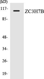 Western blot analysis of the lysates from HUVECcells using ZC3H7B antibody.