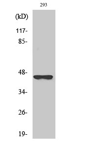 Western blot analysis of various cells using SCCA2 Polyclonal Antibody STJ95585