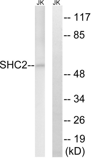 Western blot analysis of lysates from Jurkat cells, using SHC2 Antibody. The lane on the right is blocked with the synthesized peptide.