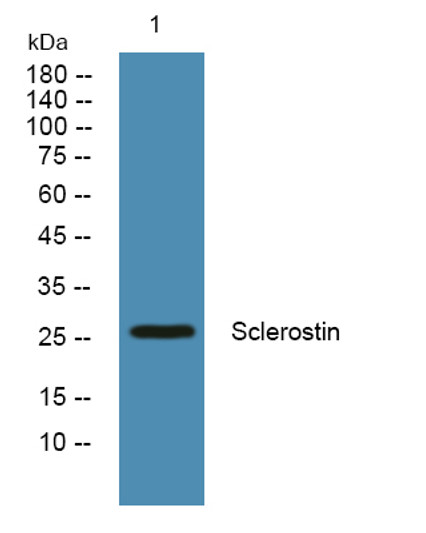 Western blot analysis of lysates from Jarkat cells, primary antibody was diluted at 1:1000, 4°C over night