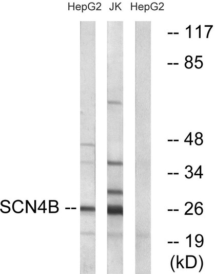 Western blot analysis of lysates from HepG2 and Jurkat cells, using SCN4B Antibody. The lane on the right is blocked with the synthesized peptide.