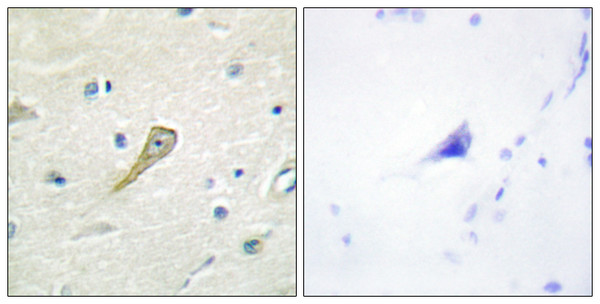 Immunohistochemistry analysis of paraffin-embedded human brain tissue, using SEMA4A Antibody. The picture on the right is blocked with the synthesized peptide.