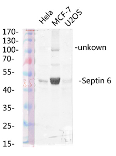 Western blot analysis of various lysis using Septin 6 Polyclonal Antibody diluted at 1：1000. Secondary antibody was diluted at 1:20000